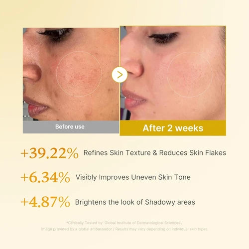 Kojic Acid Turmeric Resurfacing Toner [250ml]