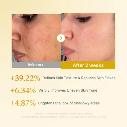 Kojic Acid Turmeric Resurfacing Toner [250ml]