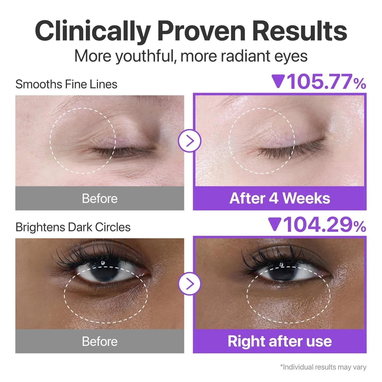 No.9 NAD+ Retinol Volumetox Eye Cream [10ml]